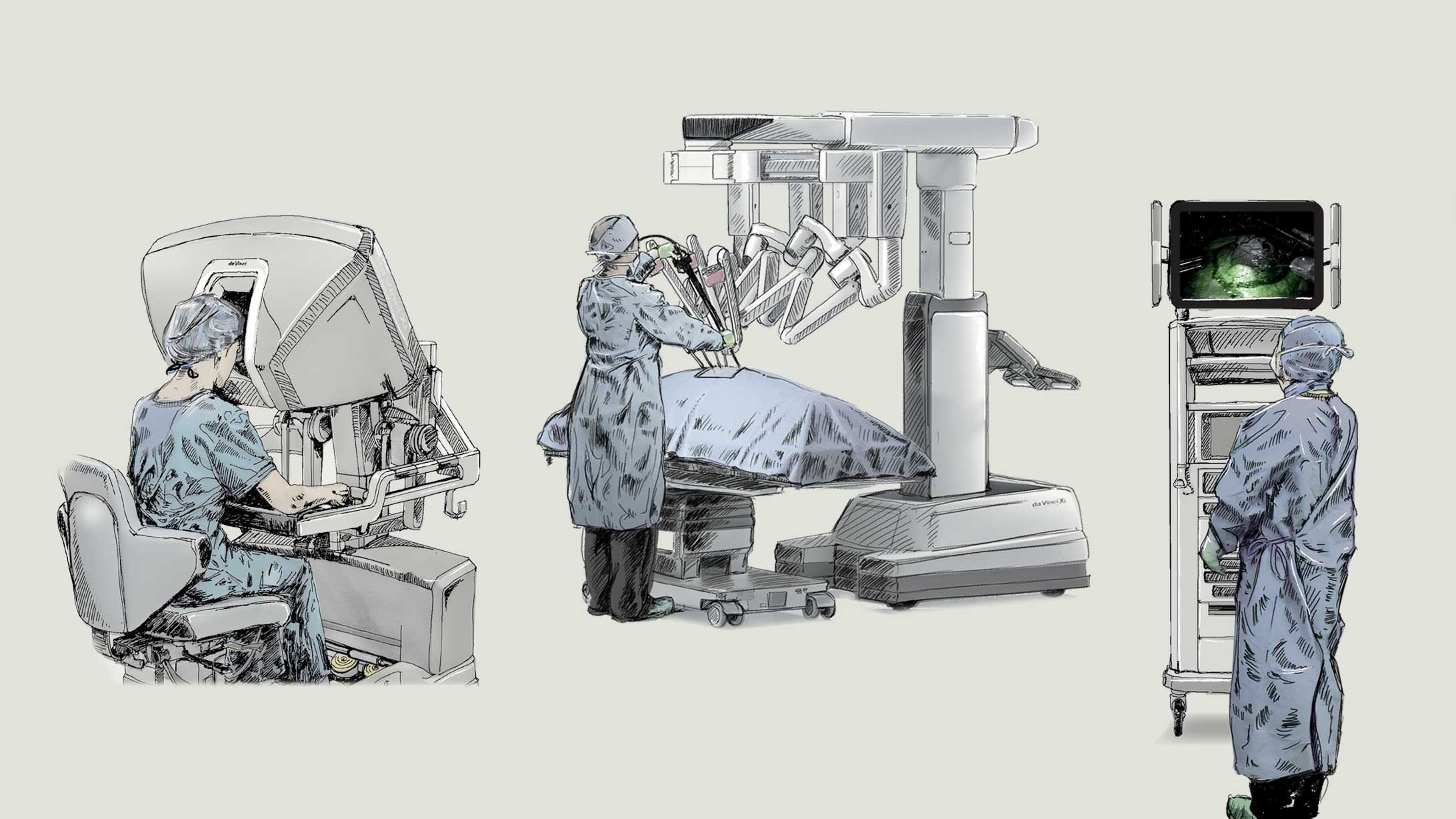 Der Da-Vinci-Operationsroboter beinhaltet eine Chirurgenkonsole, einen Patientenwagen und einen Videowagen.